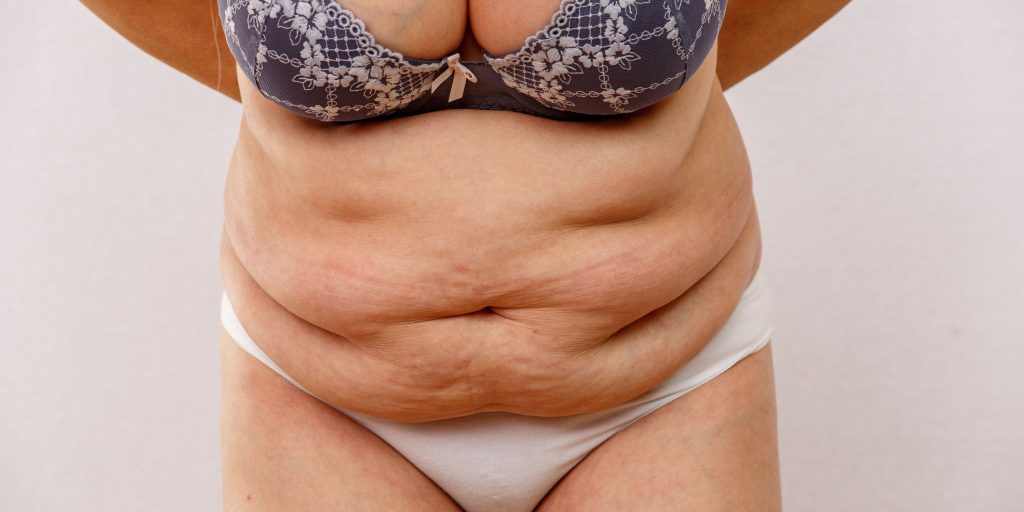 Menopause Belly Fat after 50 Picture